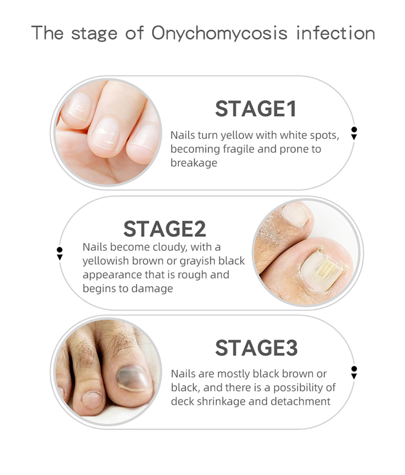 1764151030750113.jpg 英文详情_08.jpg